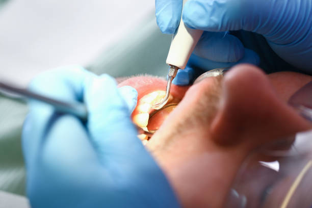 Best Urgent Care for Lost Fillings or Crowns in Fmington, AR
