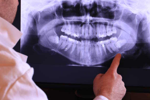 Best Emergency Treatment for Dental Infections or Abscesses in Fmington, AR