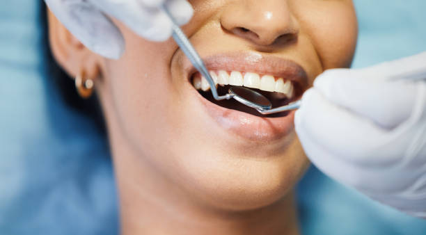 Best Emergency Denture Repair in Fmington, AR