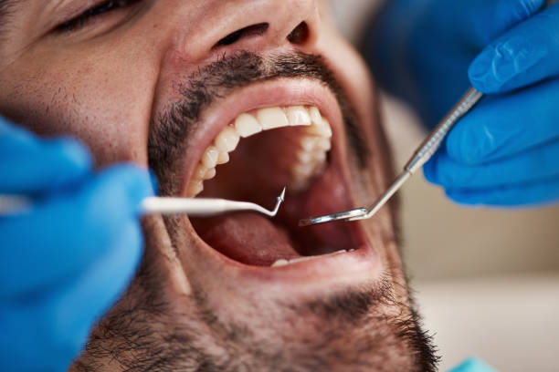 Best Emergency Wisdom Teeth Removal in Fmington, AR
